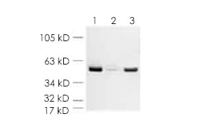 Western blot data image. All lanes: beta Actin antibody - loading control (ab8227) at 1/5000 dilution